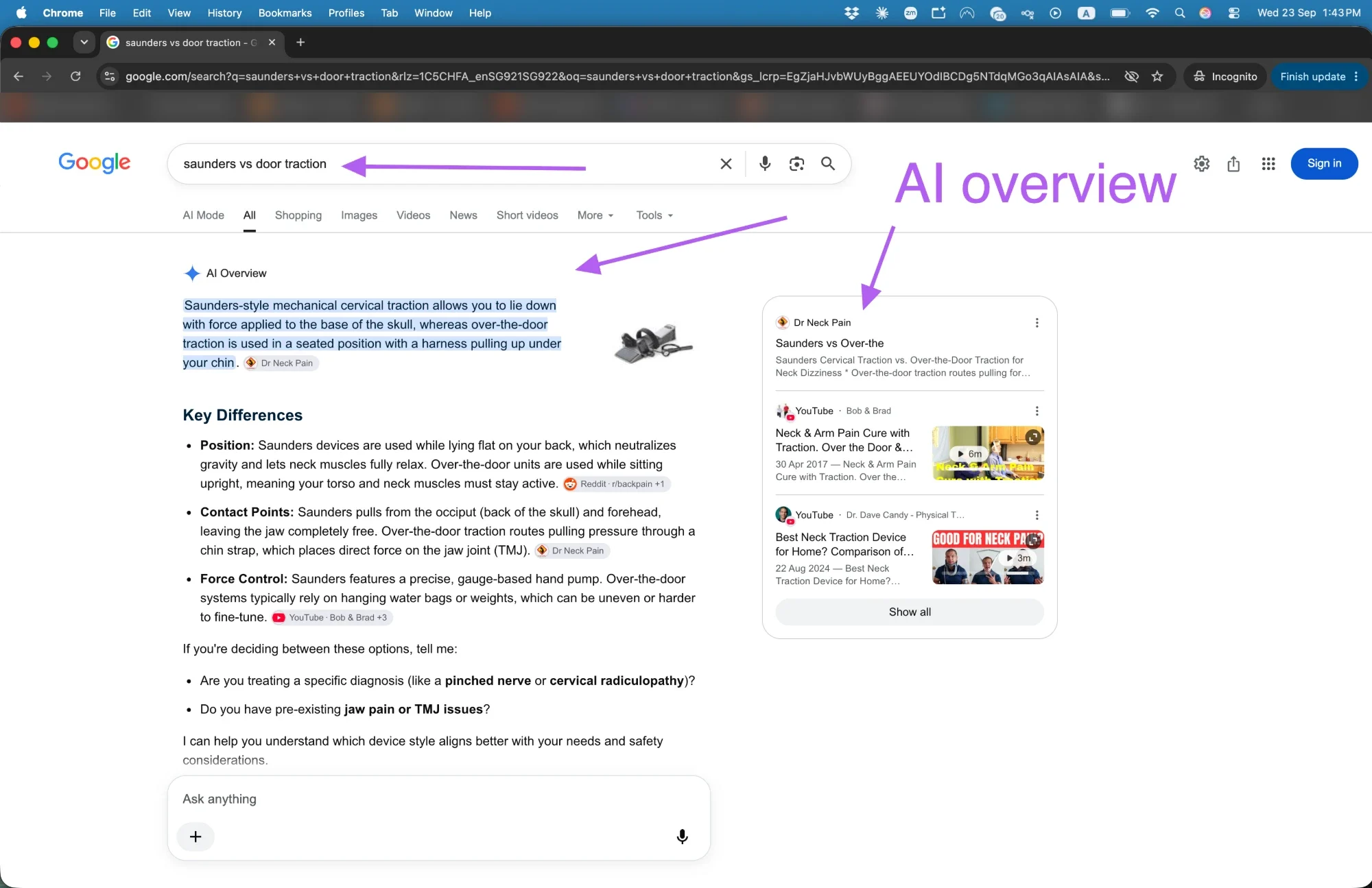 Google AI Overview in Singapore citing a chiropractic clinic's traction guide as first source within 20 hours